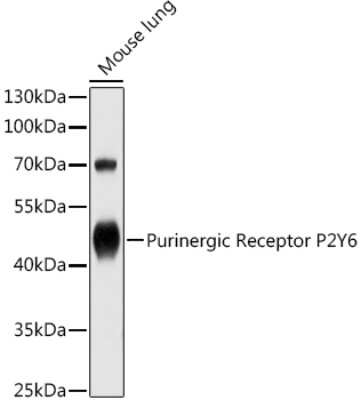 Western Blot: P2Y6/P2RY6 AntibodyAzide and BSA Free [NBP2-93862]